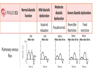 ASSESSMENT OF LEFT VENTRICULAR DIASTOLIC FUNCTION seminar 2.pptx