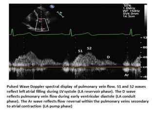 ASSESSMENT OF LEFT VENTRICULAR DIASTOLIC FUNCTION seminar 2.pptx