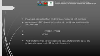 Assessment of Left Ventricular Function by Echocardiography 25 Okt 24...pdf