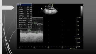 Assessment of Left Ventricular Function by Echocardiography 25 Okt 24...pdf