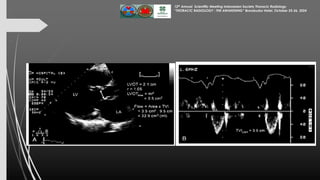 Assessment of Left Ventricular Function by Echocardiography 25 Okt 24...pdf