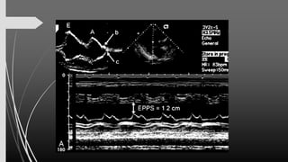 Assessment of Left Ventricular Function by Echocardiography 25 Okt 24...pdf