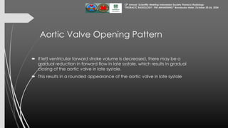 Assessment of Left Ventricular Function by Echocardiography 25 Okt 24...pdf