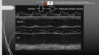 Assessment of Left Ventricular Function by Echocardiography 25 Okt 24...pdf