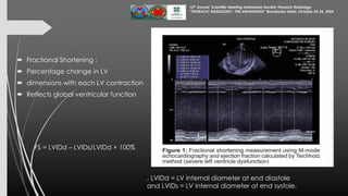 Assessment of Left Ventricular Function by Echocardiography 25 Okt 24...pdf