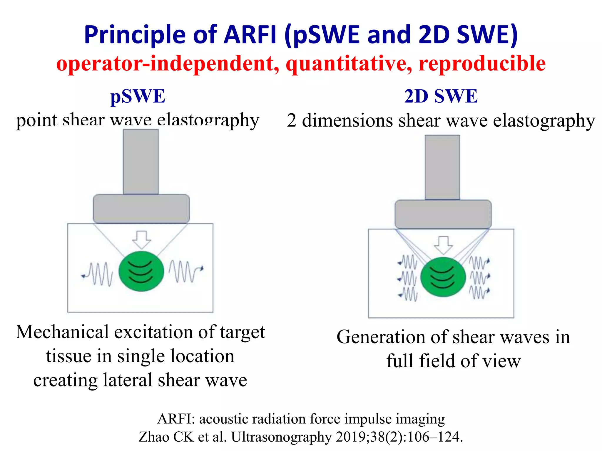 Assessment of liver fibrosis by us elastography | PPTX