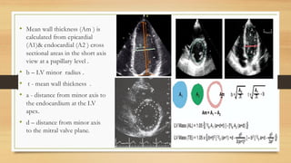 ASSESSMENT OF LV SYSTOLIC FUNCTION [Autosaved].pdf