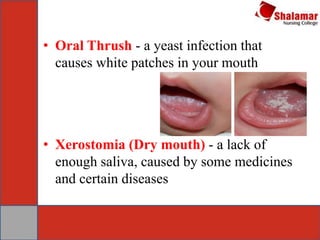 Assessment of Mouth &Pharynx | PPT