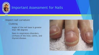 Assessment of Nails.pptx