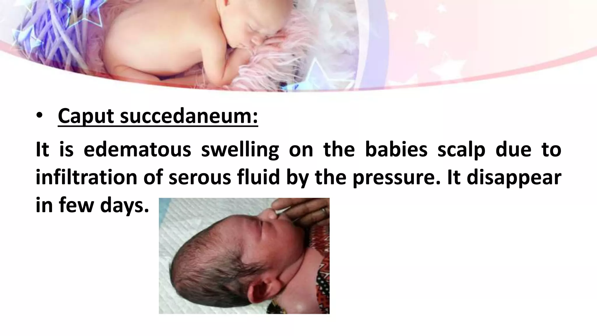 Assessment of newborn | PPTX
