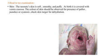 ASSESSMENT OF NEWBORN including ballard score PPTX