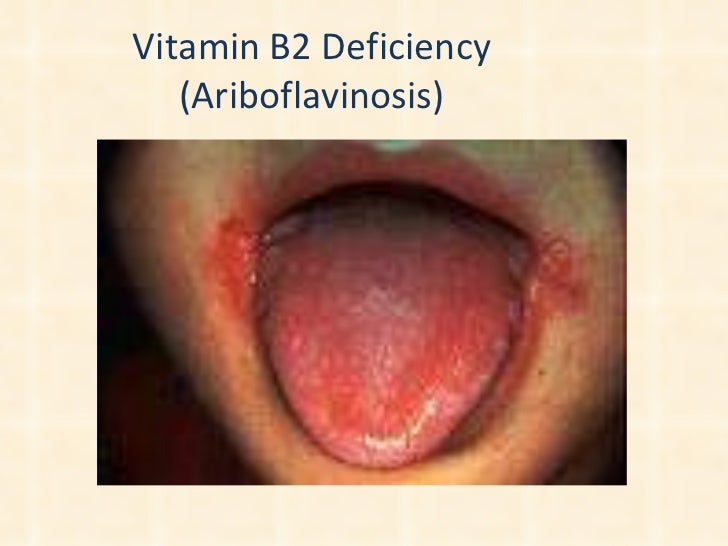 Assessment Of Nutritional Status