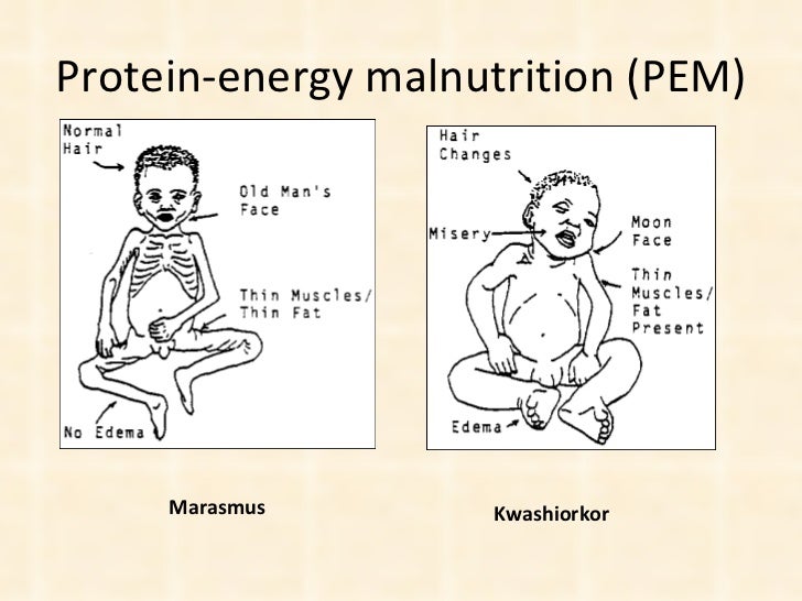 Assessment Of Nutritional Status