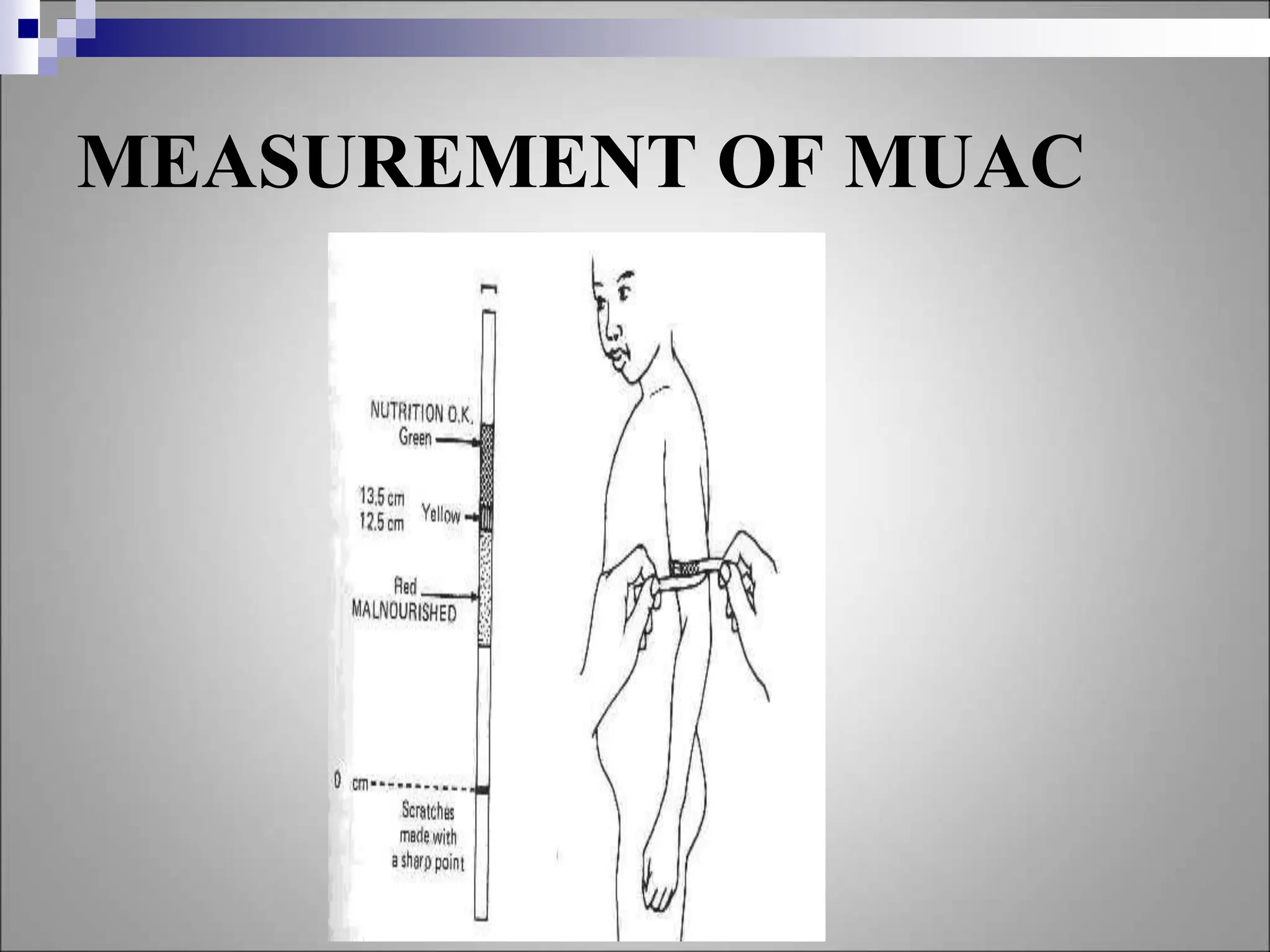 ASSESSMENT OF NUTRITIONAL STATUS - UG.ppt