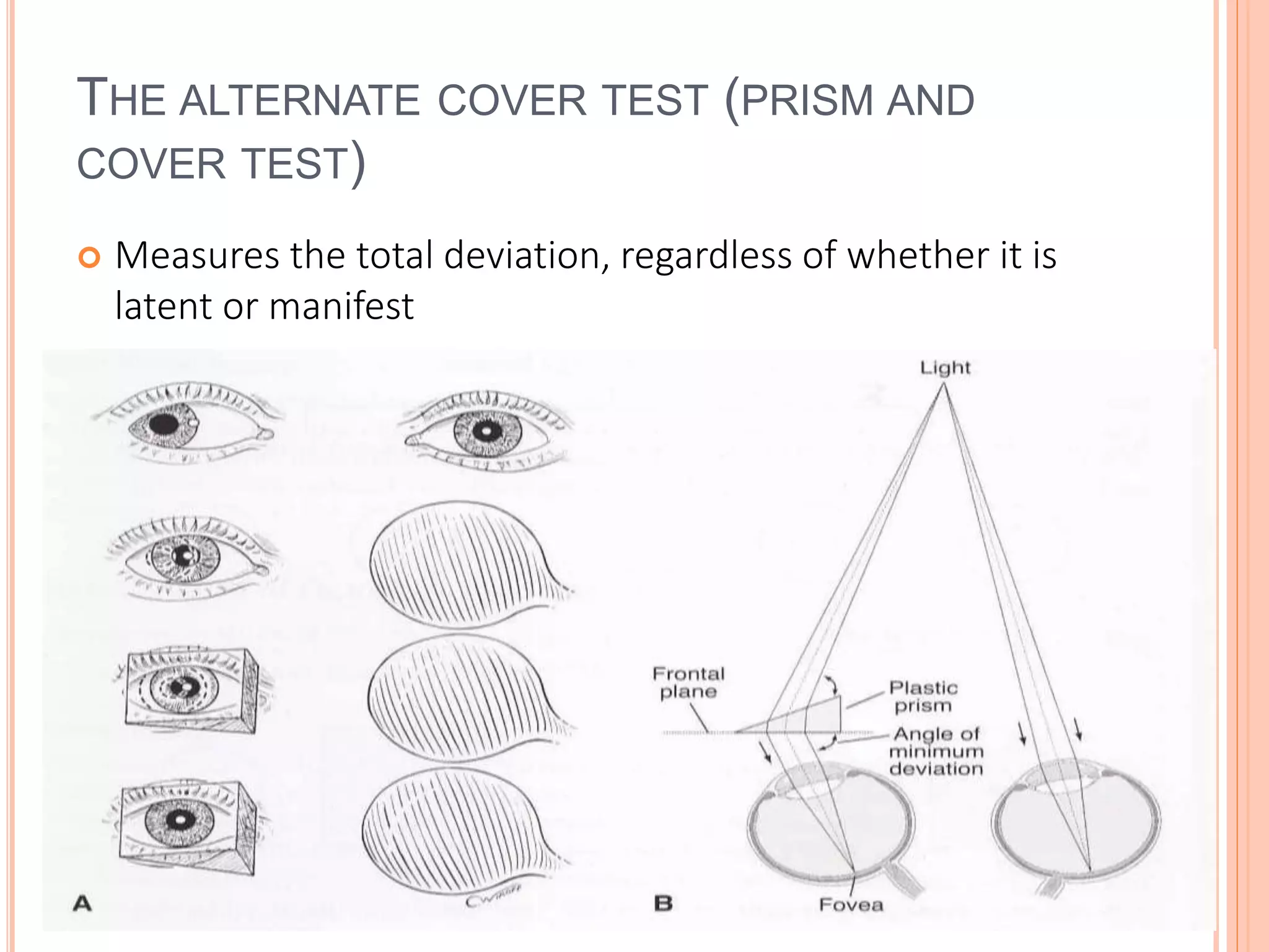 Assessment of ocular alignment | PPTX