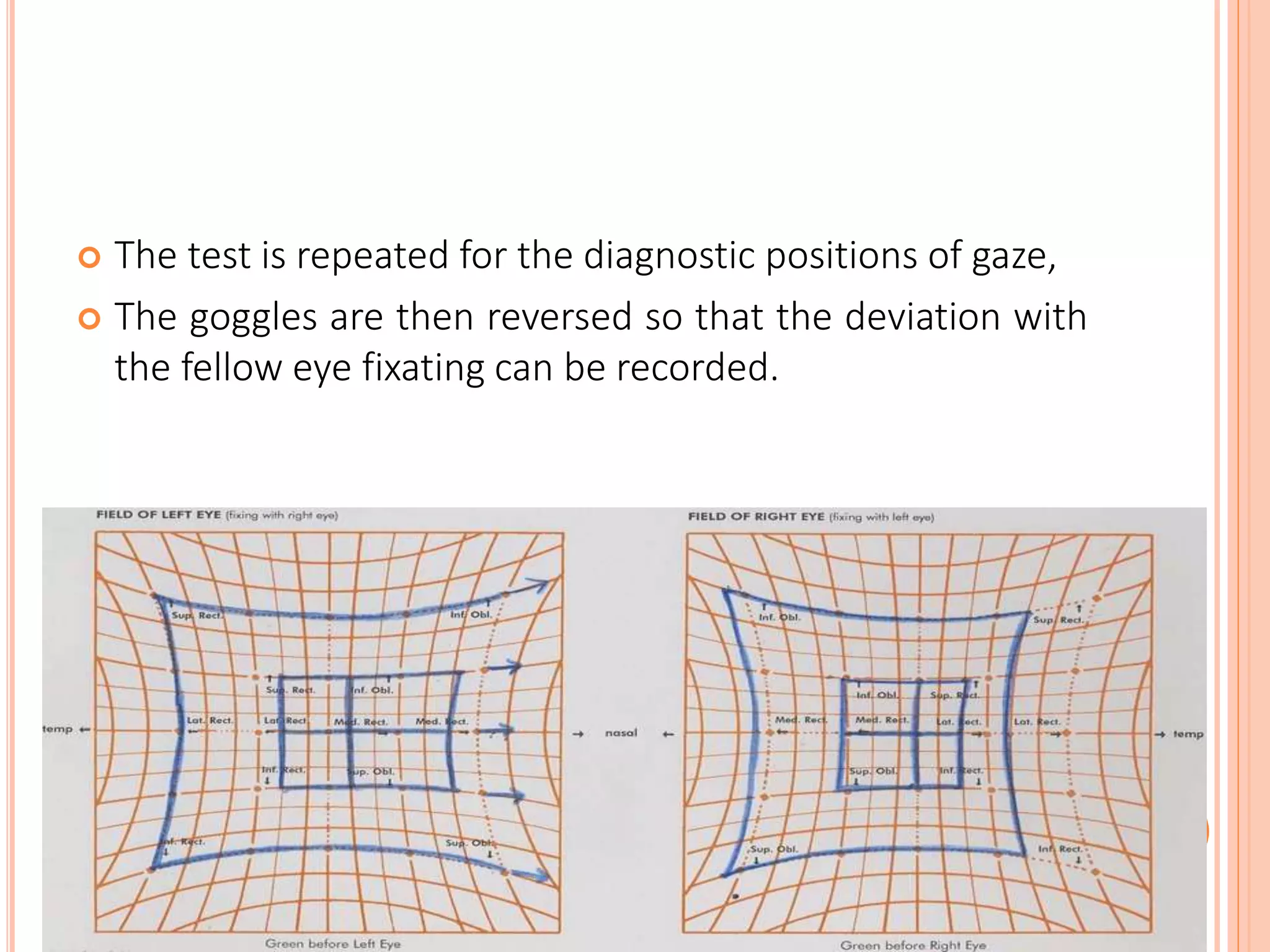 Assessment of ocular alignment | PPTX
