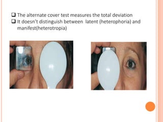  The alternate cover test measures the total deviation
 It doesn’t distinguish between latent (heterophoria) and
manifest(heterotropia)
 
