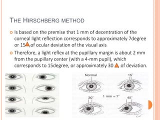 THE HIRSCHBERG METHOD
 Is based on the premise that 1 mm of decentration of the
corneal light reflection corresponds to approximately 7degree
or 15 ,of ocular deviation of the visual axis
 Therefore, a light reflex at the pupillary margin is about 2 mm
from the pupillary center (with a 4-mm pupil), which
corresponds to 15degree, or approximately 30 , of deviation.
 