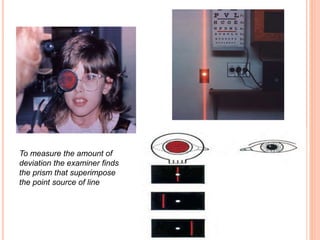 To measure the amount of
deviation the examiner finds
the prism that superimpose
the point source of line
 
