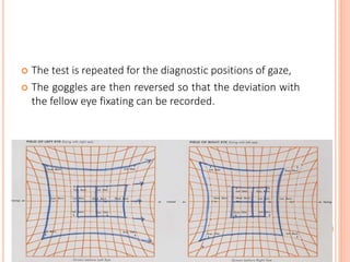  The test is repeated for the diagnostic positions of gaze,
 The goggles are then reversed so that the deviation with
the fellow eye fixating can be recorded.
 