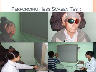 PERFORMING HESS SCREEN TEST:
 