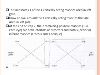 This implicates 1 of the 4 vertically acting muscles used in left
gaze.
Draw an oval around the 4 vertically acting muscles that are
used in left gaze
At the end of step 2, the 2 remaining possible muscles (1 in
each eye) are both intortors or extortors and both superior or
inferior muscles (l rectus and 1 oblique).
 