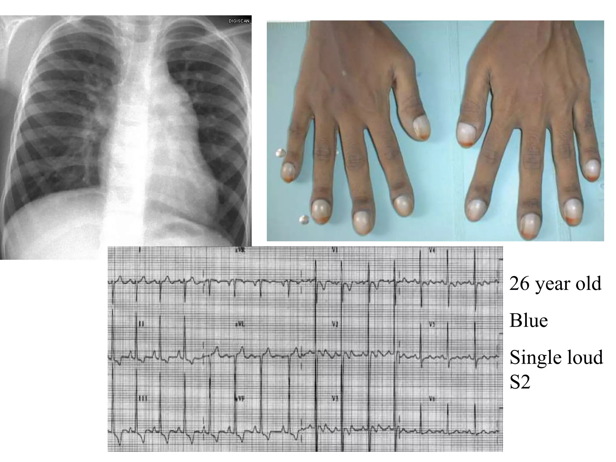 26 year old
Blue
Single loud
S2
 