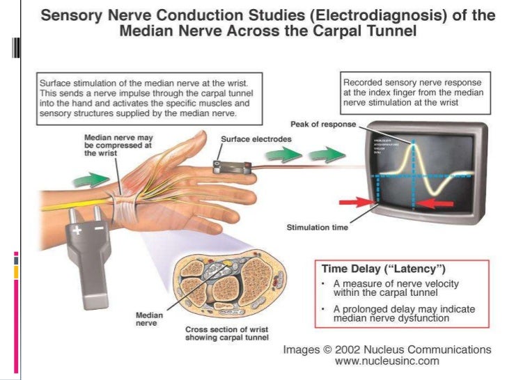 emg pain after test emg pain after test