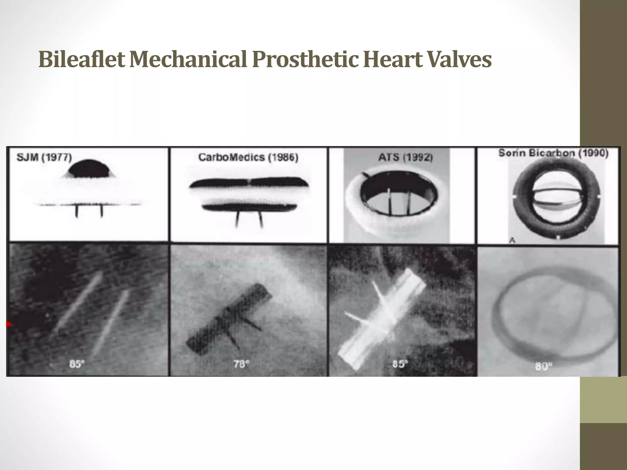 BileafletMechanicalProstheticHeartValves
 