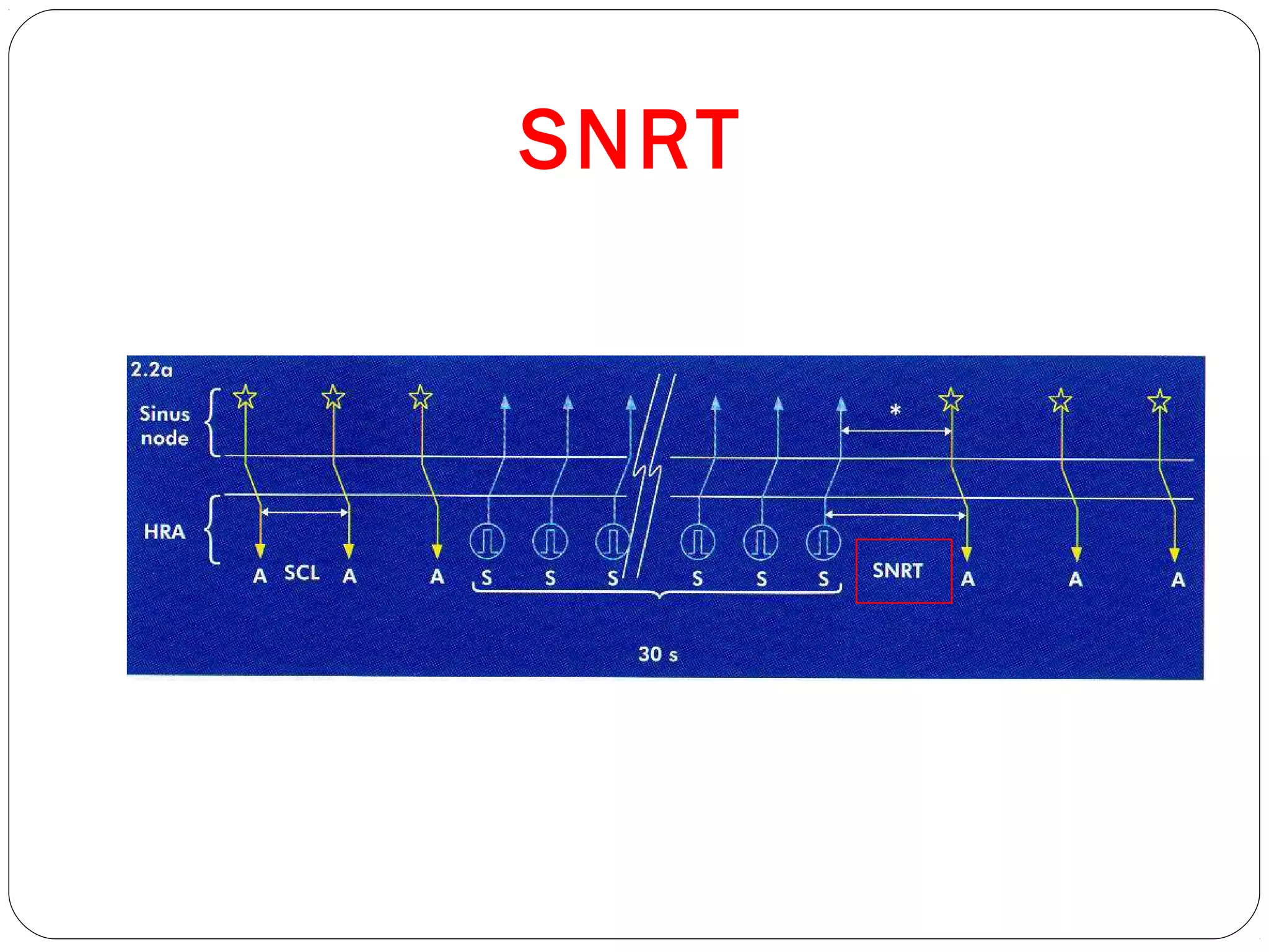 SNRT
 