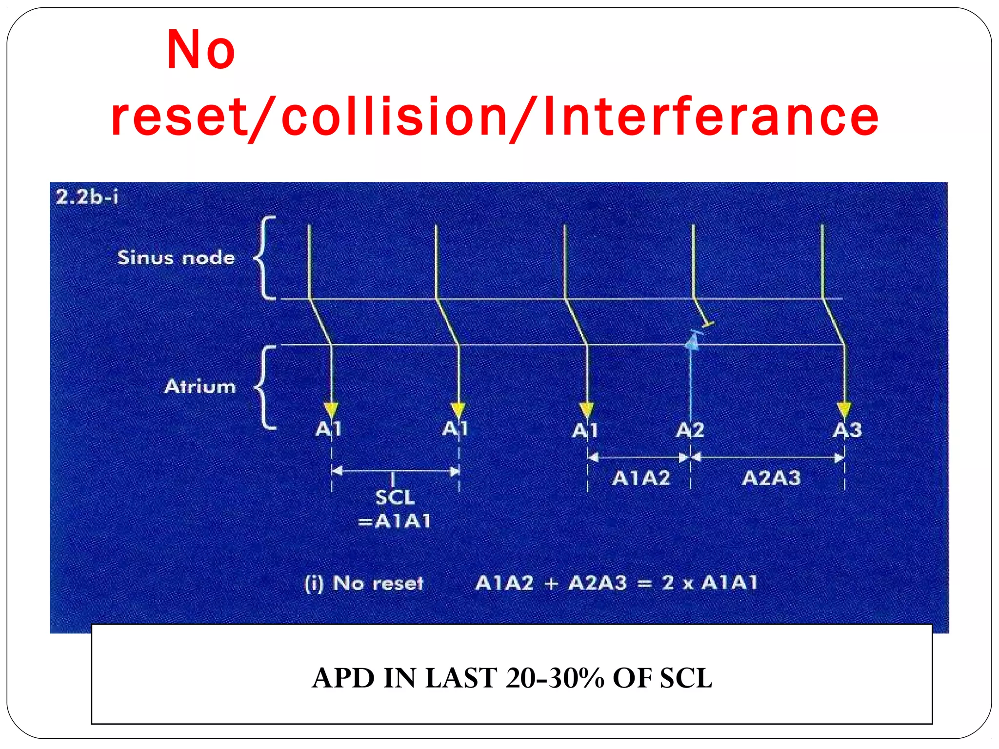 No
reset/collision/Interferance
APD IN LAST 20-30% OF SCL
 