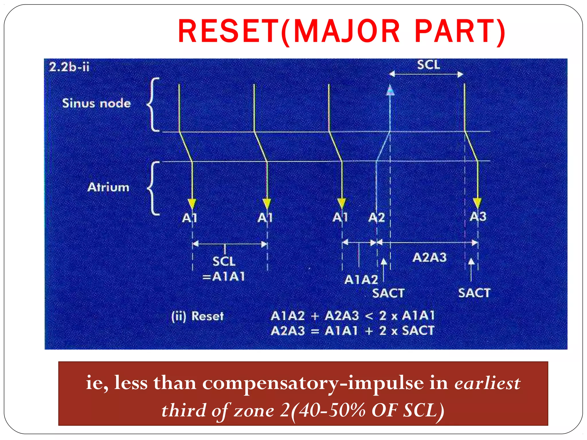 RESET(MAJOR PART)
ie, less than compensatory-impulse in earliest
third of zone 2(40-50% OF SCL)
 