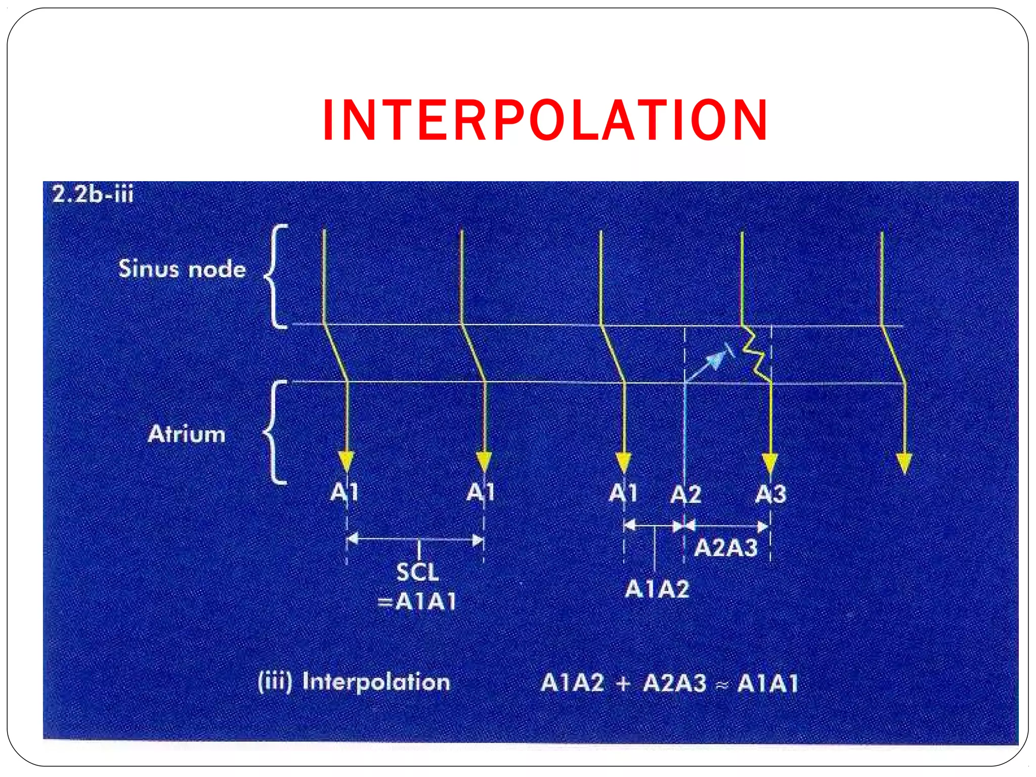 INTERPOLATION
 