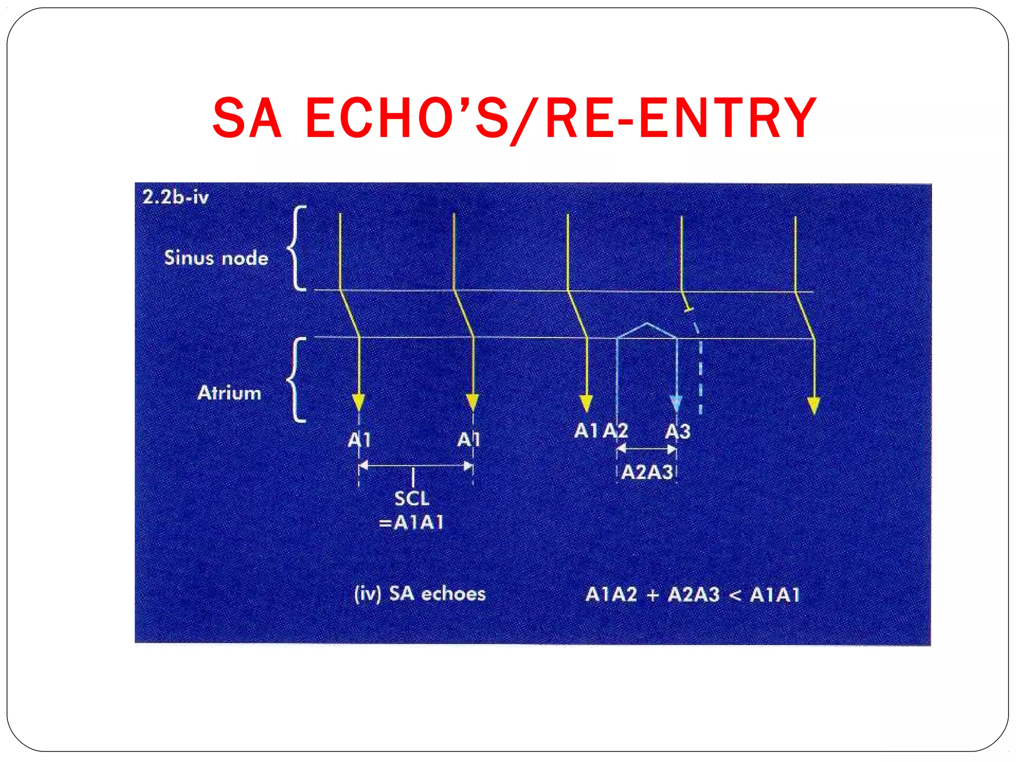 SA ECHO’S/RE-ENTRY
 