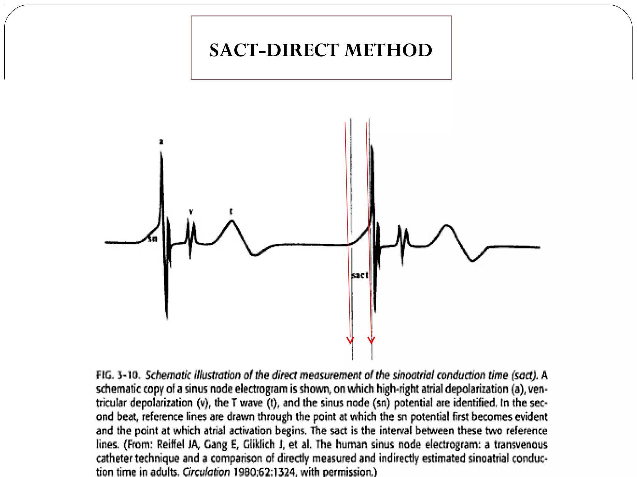 SACT-DIRECT METHOD
 