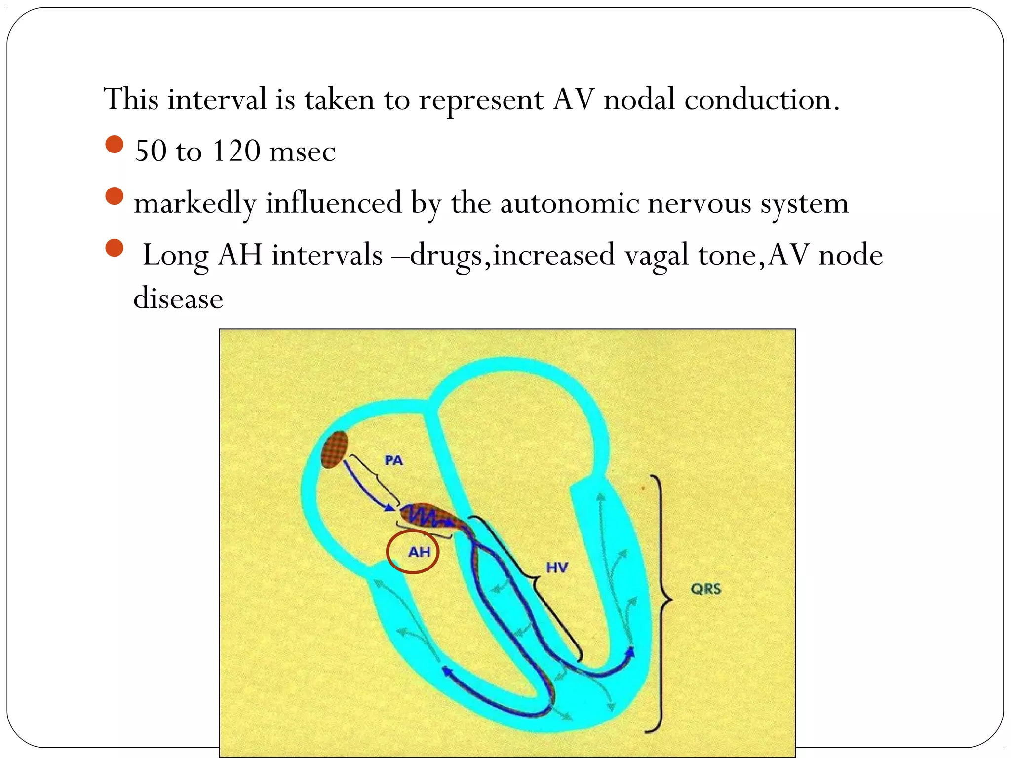 This interval is taken to represent AV nodal conduction.
50 to 120 msec
markedly influenced by the autonomic nervous system
 Long AH intervals –drugs,increased vagal tone,AV node
disease
 