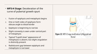 Assessment of skeletal age in Orthodontics | PPTX