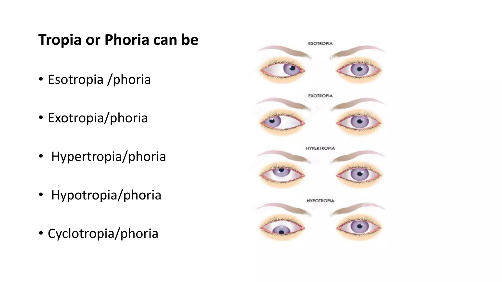Tropia or Phoria can be
• Esotropia /phoria
• Exotropia/phoria
• Hypertropia/phoria
• Hypotropia/phoria
• Cyclotropia/phoria
 
