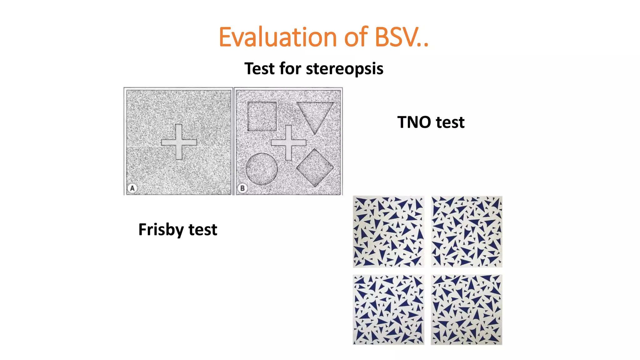 Evaluation of BSV..
Test for stereopsis
TNO test
Frisby test
 