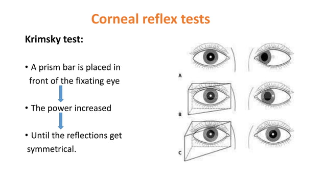 Assessment of strabismus | PDF | Eye and Vision Conditions | Diseases ...