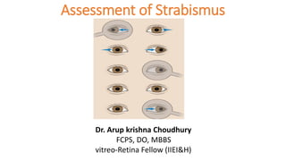 Assessment of Strabismus
Dr. Arup krishna Choudhury
FCPS, DO, MBBS
vitreo-Retina Fellow (IIEI&H)
 
