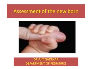 Assessment of the new born
DR AJIT GADEKAR
DEPARTMENT OF PEDIATRICS
 