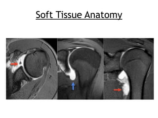 Assessment of the unstable shoulder | PDF