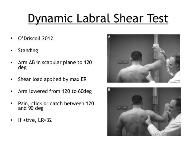 Assessment of the unstable shoulder
