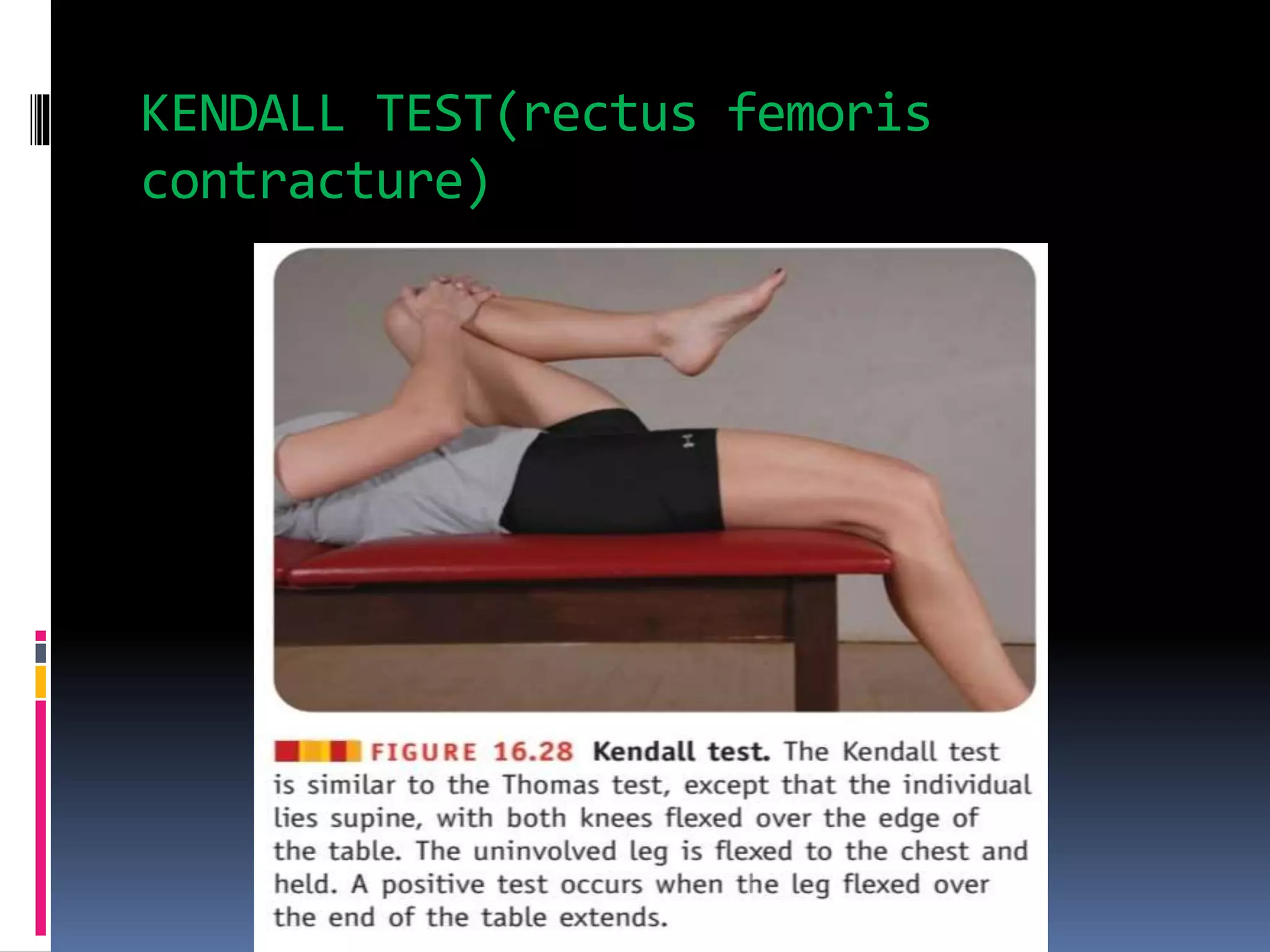 KENDALL TEST(rectus femoris
contracture)
 