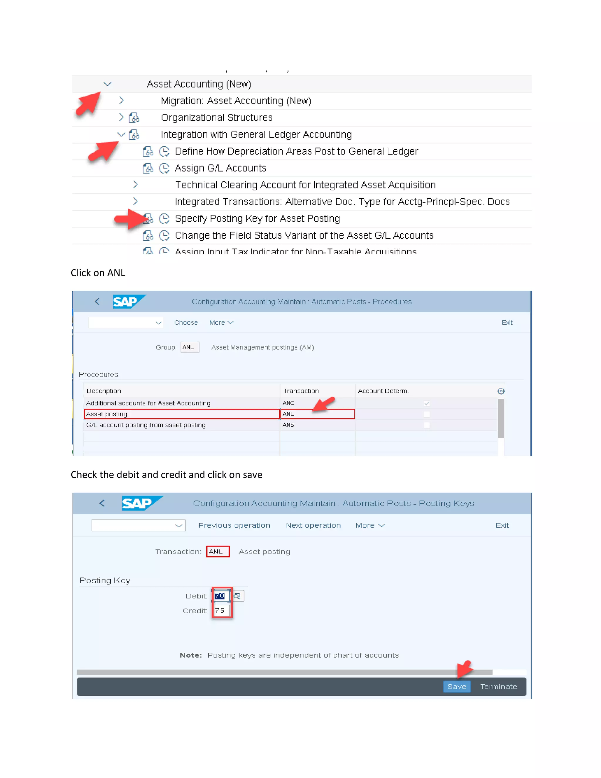 Click on ANL
Check the debit and credit and click on save
 