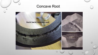 Concave Root
 