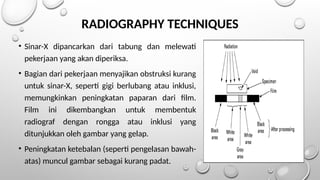 RADIOGRAPHY TECHNIQUES
• Sinar-X dipancarkan dari tabung dan melewati
pekerjaan yang akan diperiksa.
• Bagian dari pekerjaan menyajikan obstruksi kurang
untuk sinar-X, seperti gigi berlubang atau inklusi,
memungkinkan peningkatan paparan dari film.
Film ini dikembangkan untuk membentuk
radiograf dengan rongga atau inklusi yang
ditunjukkan oleh gambar yang gelap.
• Peningkatan ketebalan (seperti pengelasan bawah-
atas) muncul gambar sebagai kurang padat.
 
