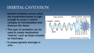 INERTIAL CAVITATION
• Inertial cavitation occurs when
the transmitted power is high
enough to cause a violent
collapse of microbubbles that
destroys the tissue
• This type of cavitation can be
used to create mechanical
“lesions” such as those created
by histotripsy.
• It causes genetic damage in
vitro.
10
 