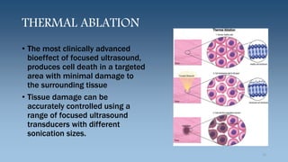 THERMAL ABLATION
• The most clinically advanced
bioeffect of focused ultrasound,
produces cell death in a targeted
area with minimal damage to
the surrounding tissue
• Tissue damage can be
accurately controlled using a
range of focused ultrasound
transducers with different
sonication sizes.
12
 